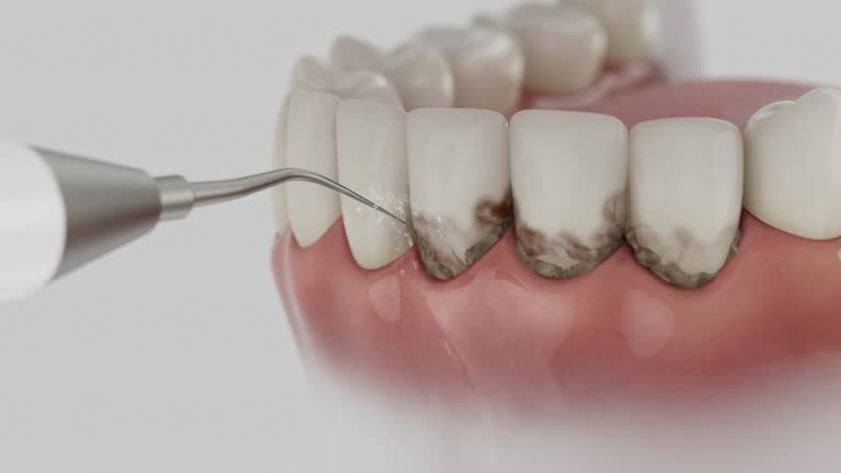 Reliable Dental Implants contractor in Norcross, GA by Smile Center Dentistry